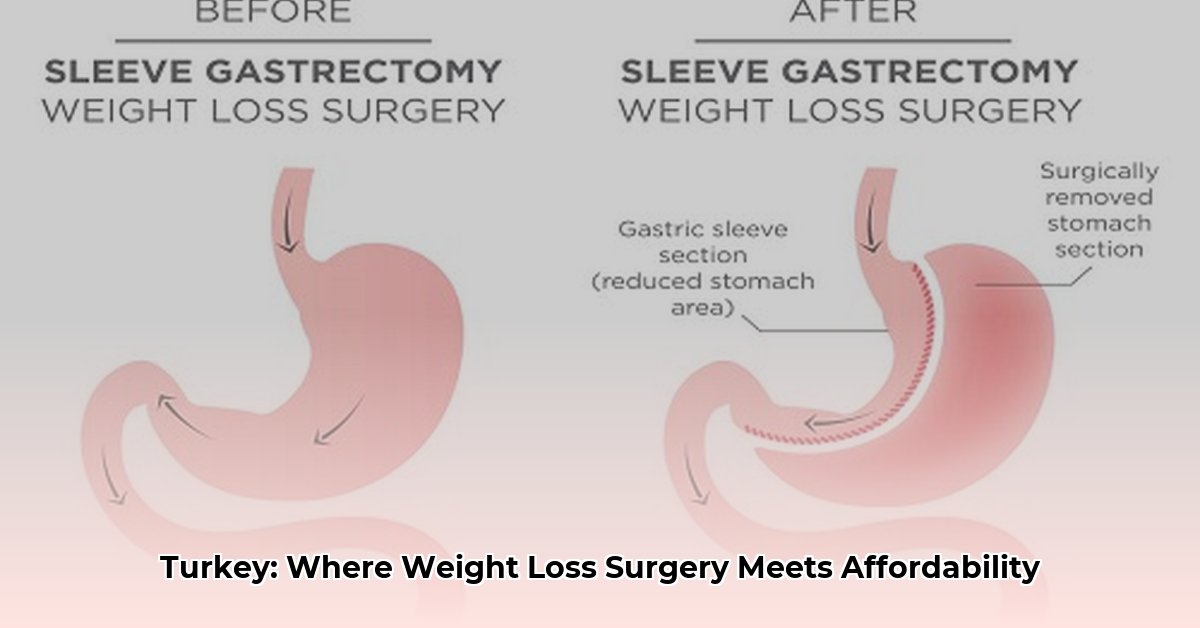 weight loss surgery in turkey